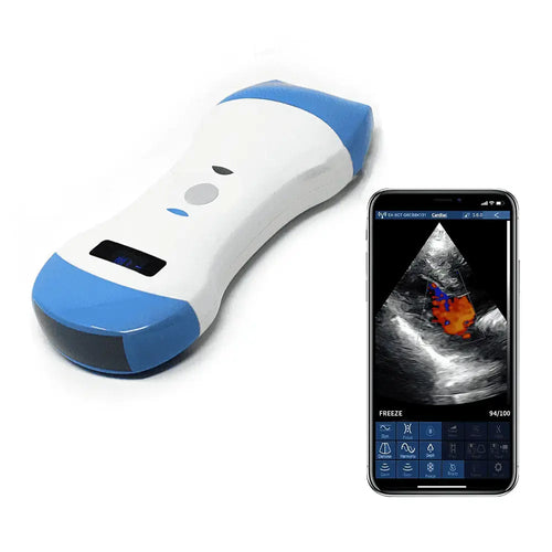 wireless 3-in-1 handheld ultrasound scanner with linear convex and phased array probes